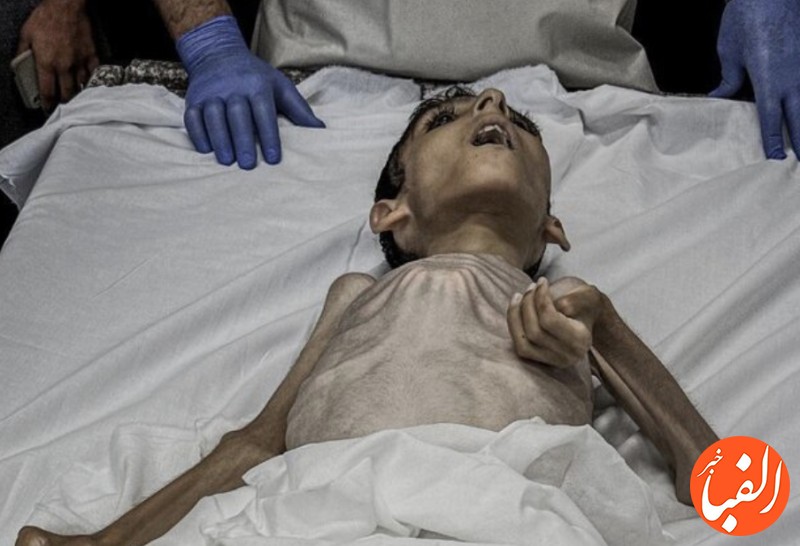سازمان-ملل-کودکان-غزه-از-گرسنگی-جان-می-دهند-کمک-ها-نمی-رسد